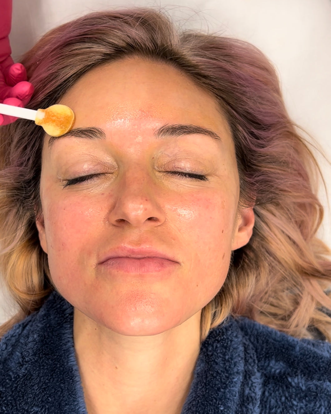 Pretty Peel (In-Office Only)